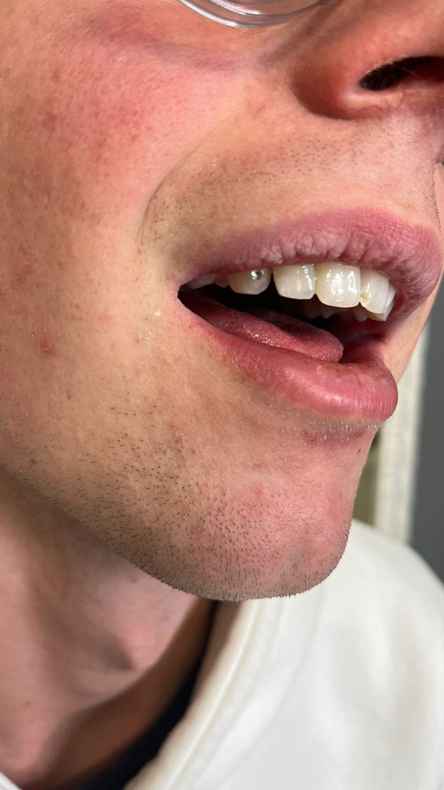 Piercing alla lingua — Golden Skin Bergamo