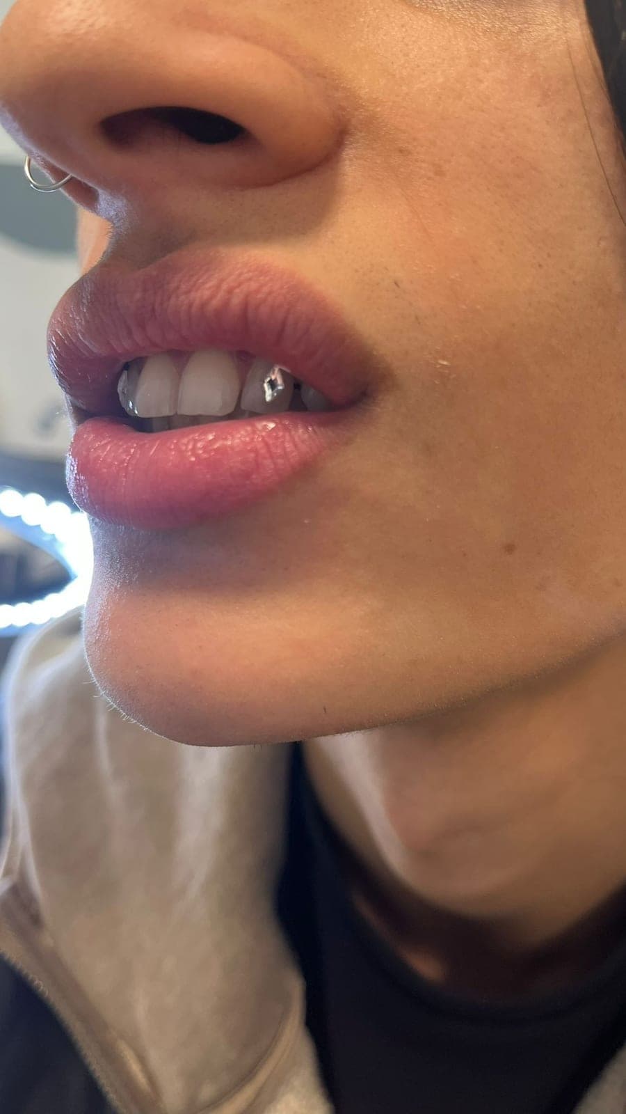 Tooth gem — Golden Skin Bergamo